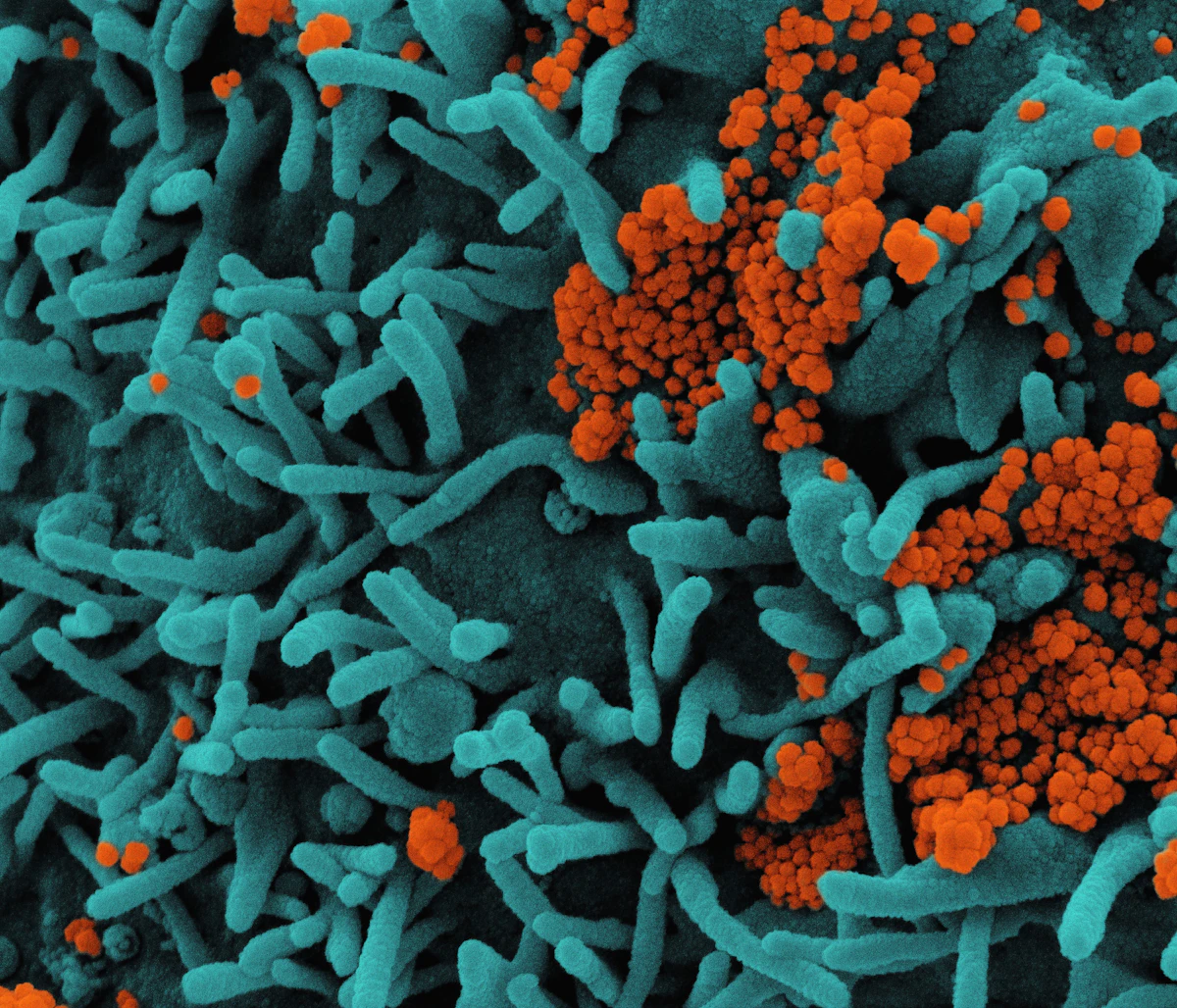Microscope image of bacteria