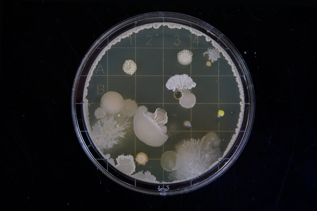 Bacterial colonies growing in a petri dish