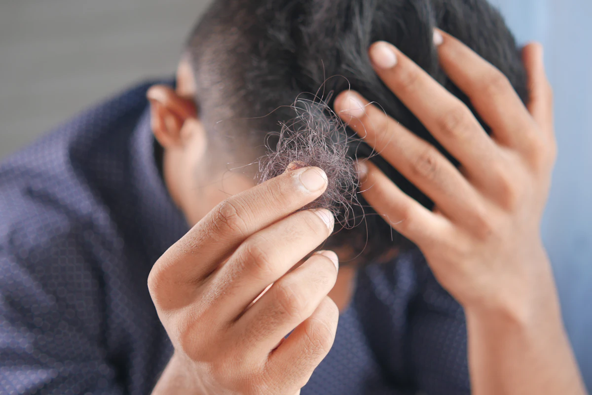 A man examining thinning hair between his fingers
